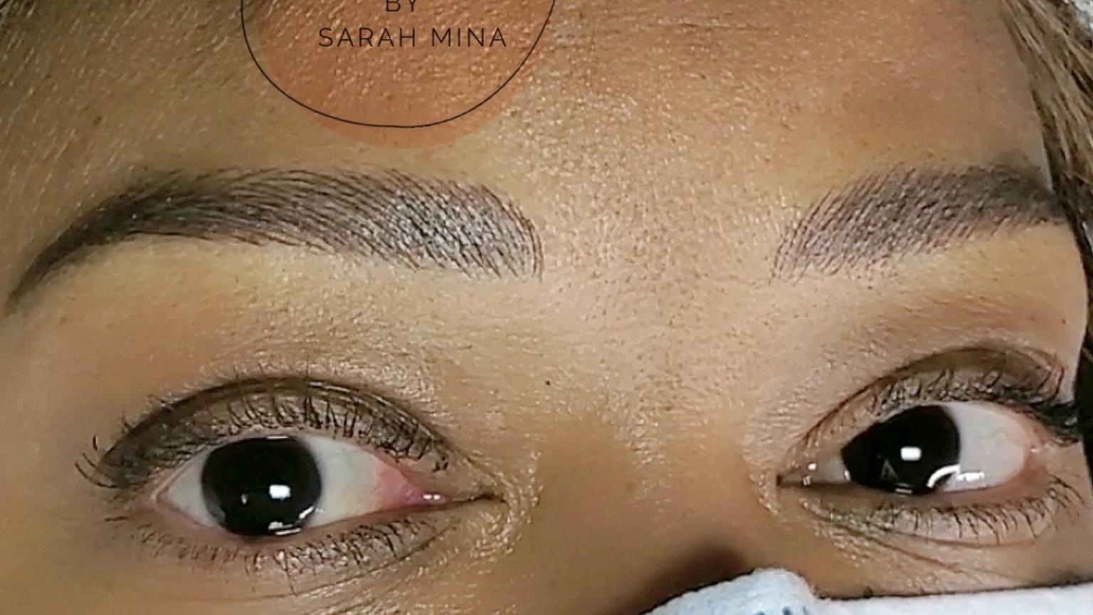 After treatment brow definition with eyes closed